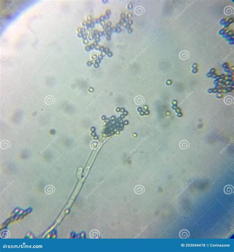 Penicillium Fungi Microscope