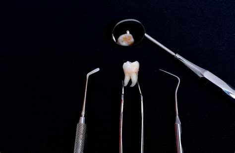 Image result for Wisdom Teeth Removal Procedure