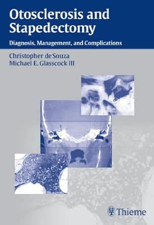 Otosclerosis and Stapedectomy: Diagnosis, Management, and Complications ...
