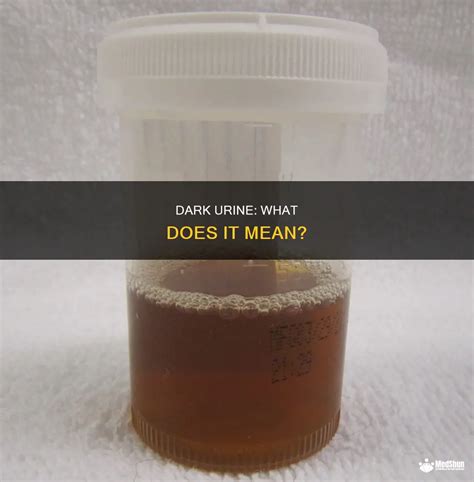Dark Brown Urine Pregnancy