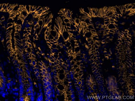 E-cadherin antibody (65241-1-Ig) | Proteintech