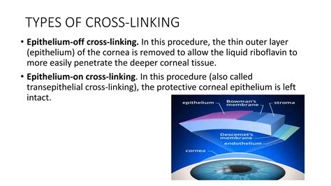 Cross Linking Surgery