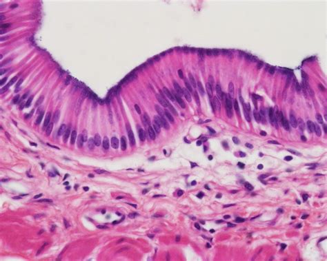 Function Of Simple Columnar Epithelial Tissue at Max Kim blog