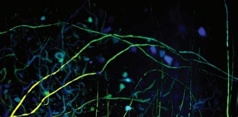 Image result for Luxendo Muvi Image Processing Tutorial