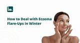 How to Deal with Eczema Flare-Ups in Winter – Belogical Wellness ...