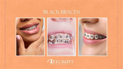 Orange And Black Braces Color