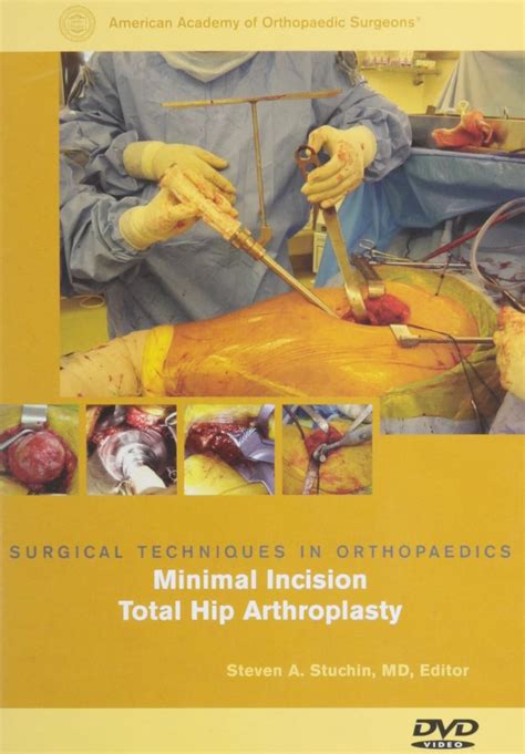 Buy Surgical Techniques in Orthopaedics: Minimal Incision Total Hip ...