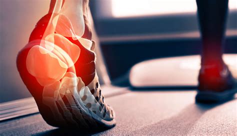 8 Effective Home Remedies To Treat Achilles Tendon Pain - lifeberrys.com