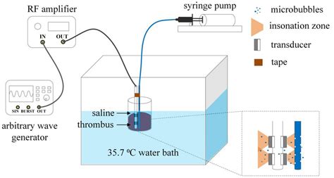 Efficacy Estimation of Microbubble-Assisted Local Sonothrombolysis ...