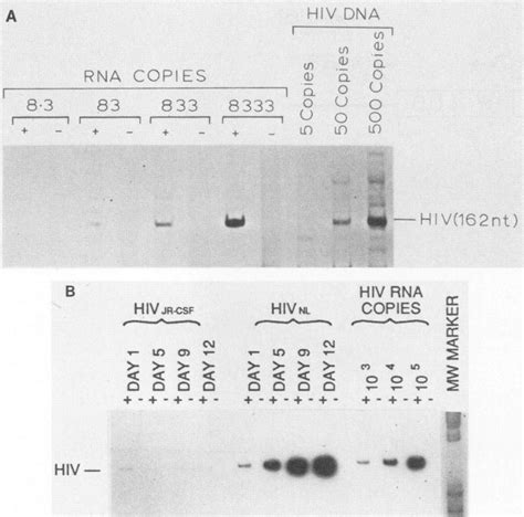 Image result for Reverse Transcriptase PCR
