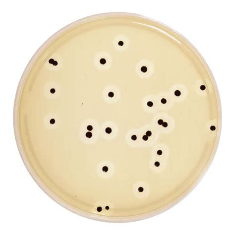 Agar Plate - Mueller Hinton Agar Plate Manufacturer from Hyderabad