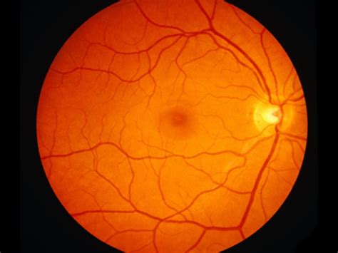 DD Eye Institute - One of the largest premium eye institute in india