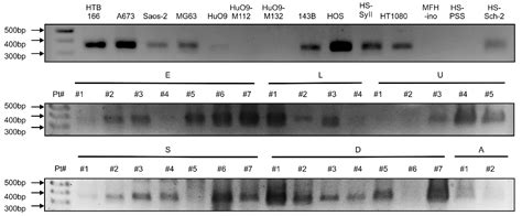 GPR64, Screened from Ewing Sarcoma Cells, Is a Potential Target for ...