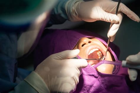 Wisdom Teeth Extraction 的图像结果