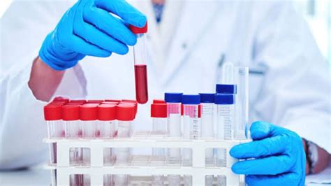 28 Tests in One Blood Test Package? Know More!