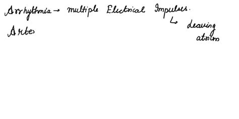 Image result for Atrial Flutter Synchronized Cardioversion