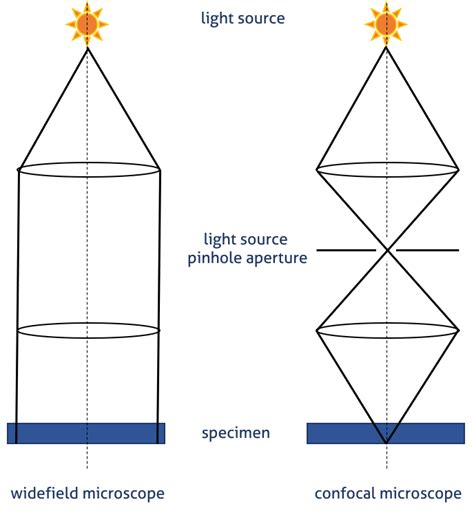IF imaging: Widefield versus confocal microscopy | Proteintech Group