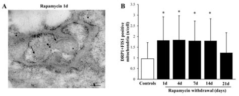 Rapamycin Ameliorates Defects in Mitochondrial Fission and Mitophagy in ...