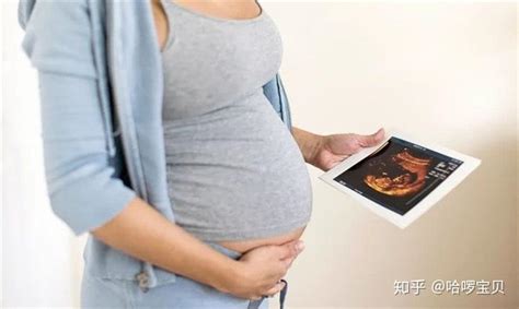 孕41周未分娩要催产，为什么别人能打催产素，我却要用“球囊”？ - 知乎