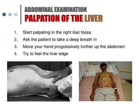 PPT - ABDOMINAL EXAMINATION PowerPoint Presentation, free download - ID:9245723
