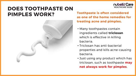 Image result for Does Toothpaste Help Pimples