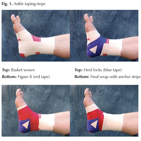 Ankle Injury Wrap