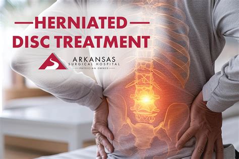 Herniated Disc Treatment - Arkansas Surgical Hospital