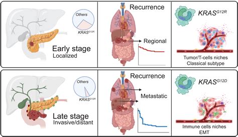 The KRAS mutational spectrum and its clinical implications in pancreatic cancer: Cancer Cell