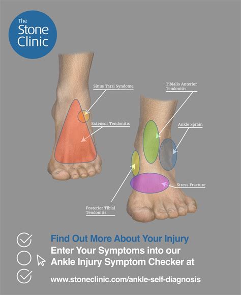 Foot Pain Chart