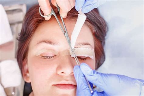 Ptosis Treatment