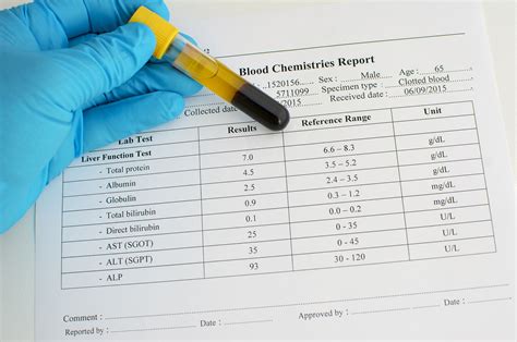 What is Beta Globulin, Serum?