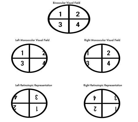 Bitemporal hemianopia - wikidoc