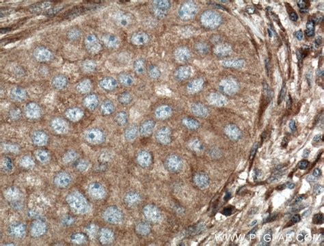 ARF5 antibody (15281-1-AP) | Proteintech