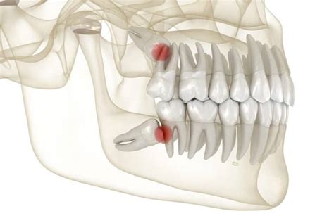 Wisdom Teeth Function 的图像结果