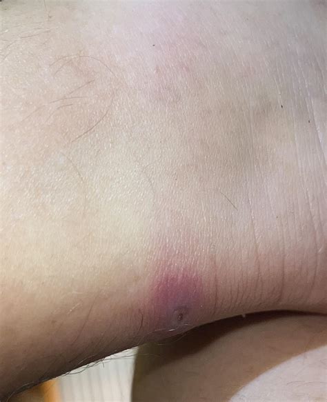 Yellow Jacket Bite Dog at Arthur Popp blog