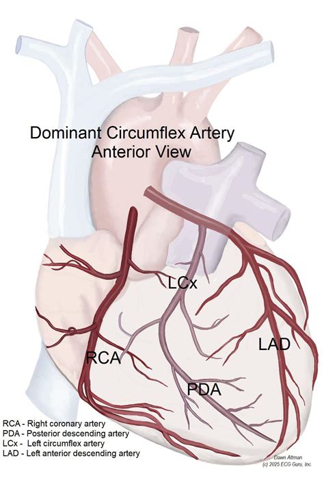 Left Circumflex Artery