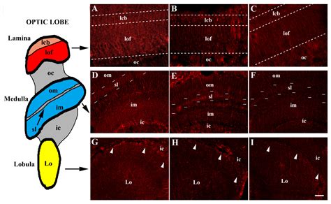 Immunohistochemical Distribution of Serotonin Transporter (SERT) in the ...