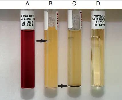 Image result for Positive Nitrate Test
