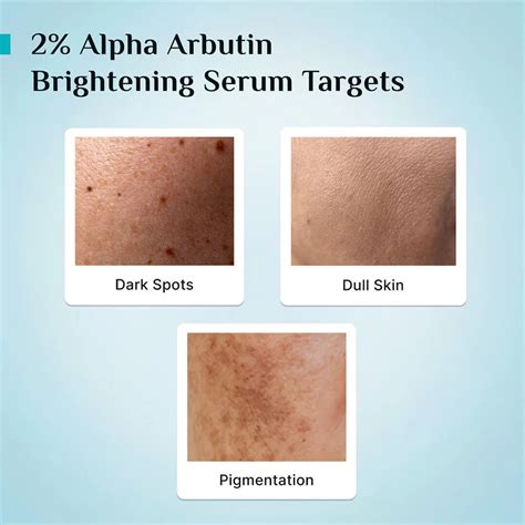 pilgrim 2% Alpha Arbutin Brightening Serum With 3% Vitamin C 30ml ...