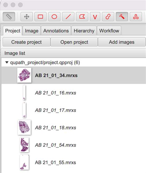 Image result for QuPath Basics