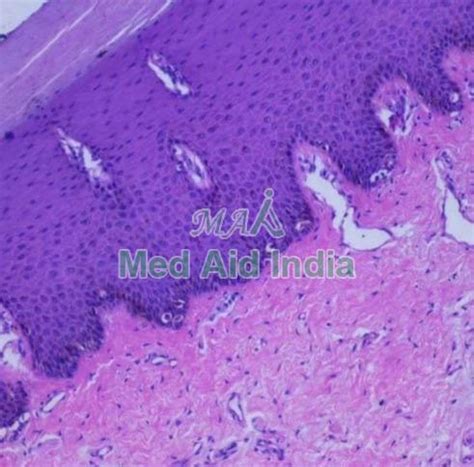 Oral Pathology Prepared Microscope Slide Manufacturer, Supplier from Noida