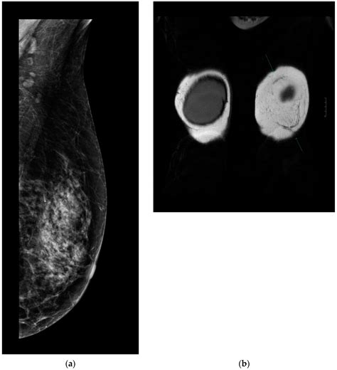 Long-Term Dynamic Changes in Cosmetic Outcomes and Patient Satisfaction ...