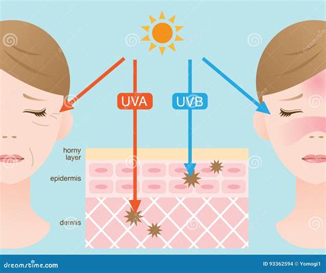 The Difference Between UVA And UVB Rays Penetration. Infographic Skin Illustration. The Effect ...