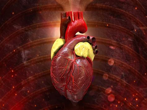 Aortic Aneurysm Is Often Mistaken For A Heart Attack; Here's Why ...