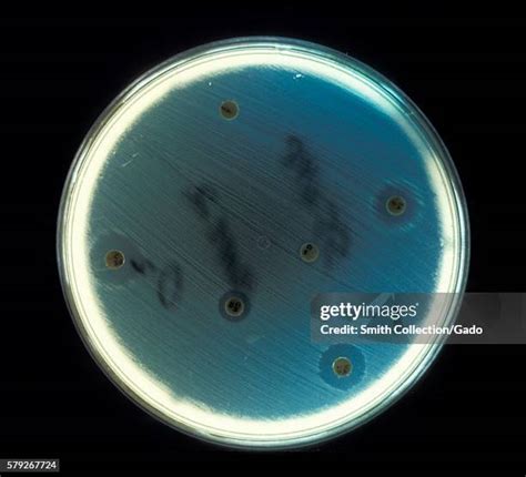 Image result for Enterococcus Faecalis MSA Plate