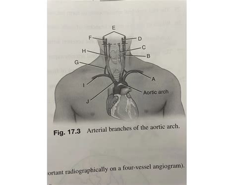 arterial branches of aortic arch Quiz