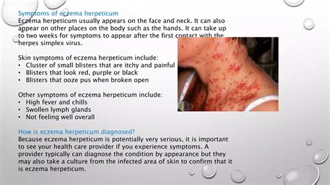 ECZEMA - dermatology case presentation | PPTX