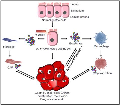 Helicobacter pylori-Induced Inflammation: Possible Factors Modulating ...