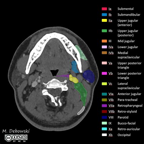 Ct Neck Levels Radiology at Pamela Ottley blog