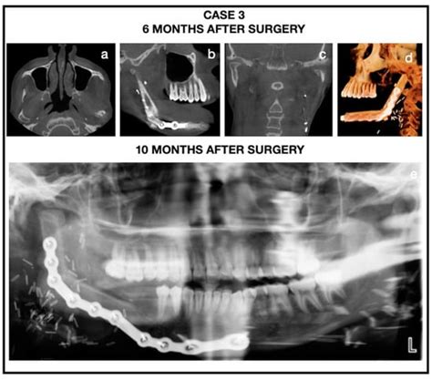 Surgeries | An Open Access Journal from MDPI